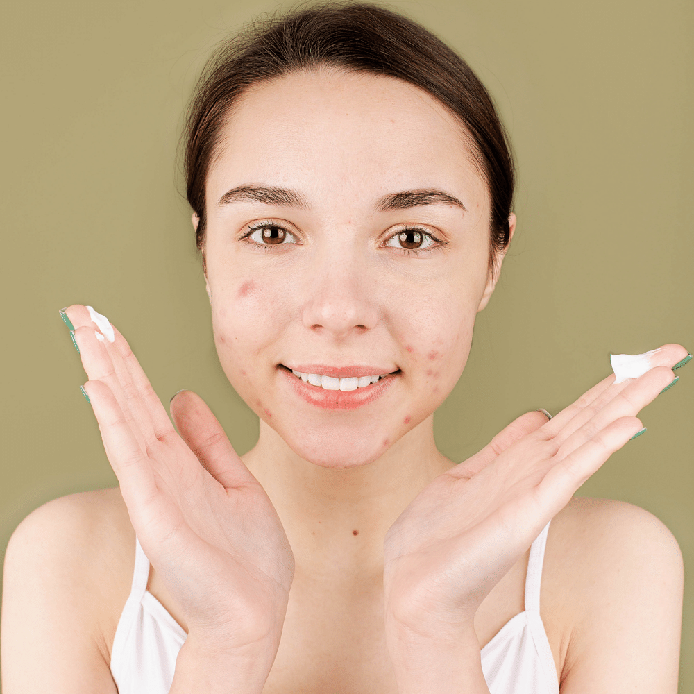 acne scar treatment