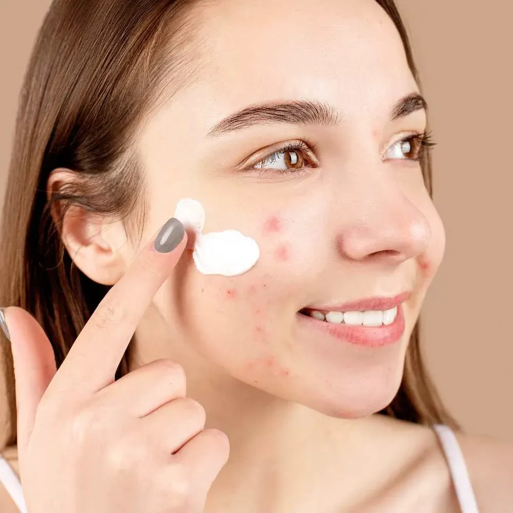 Woman applying the best primer to hide acne scars