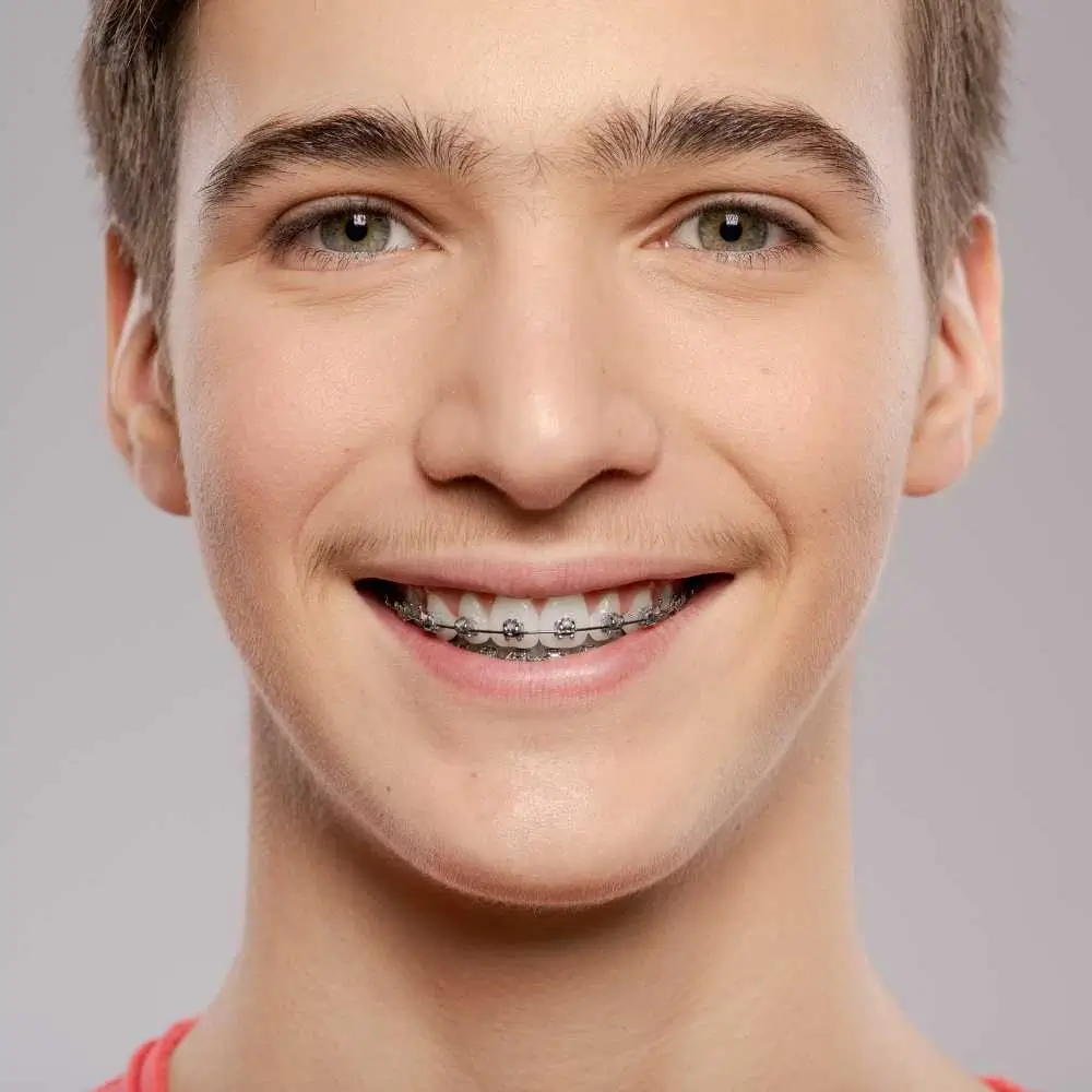 Young teen boy with clear bright eyes wearing braces on his teeth