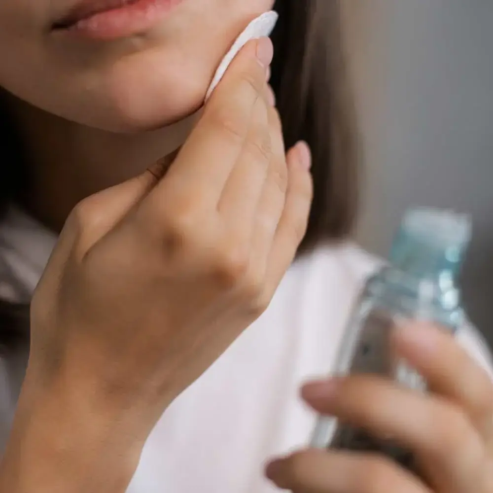 Acne-beating toner in hand