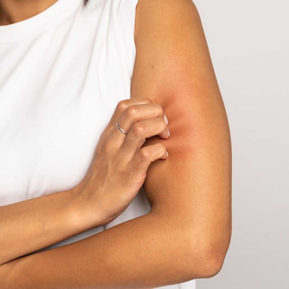 closeup of woman's dry and itchy arm