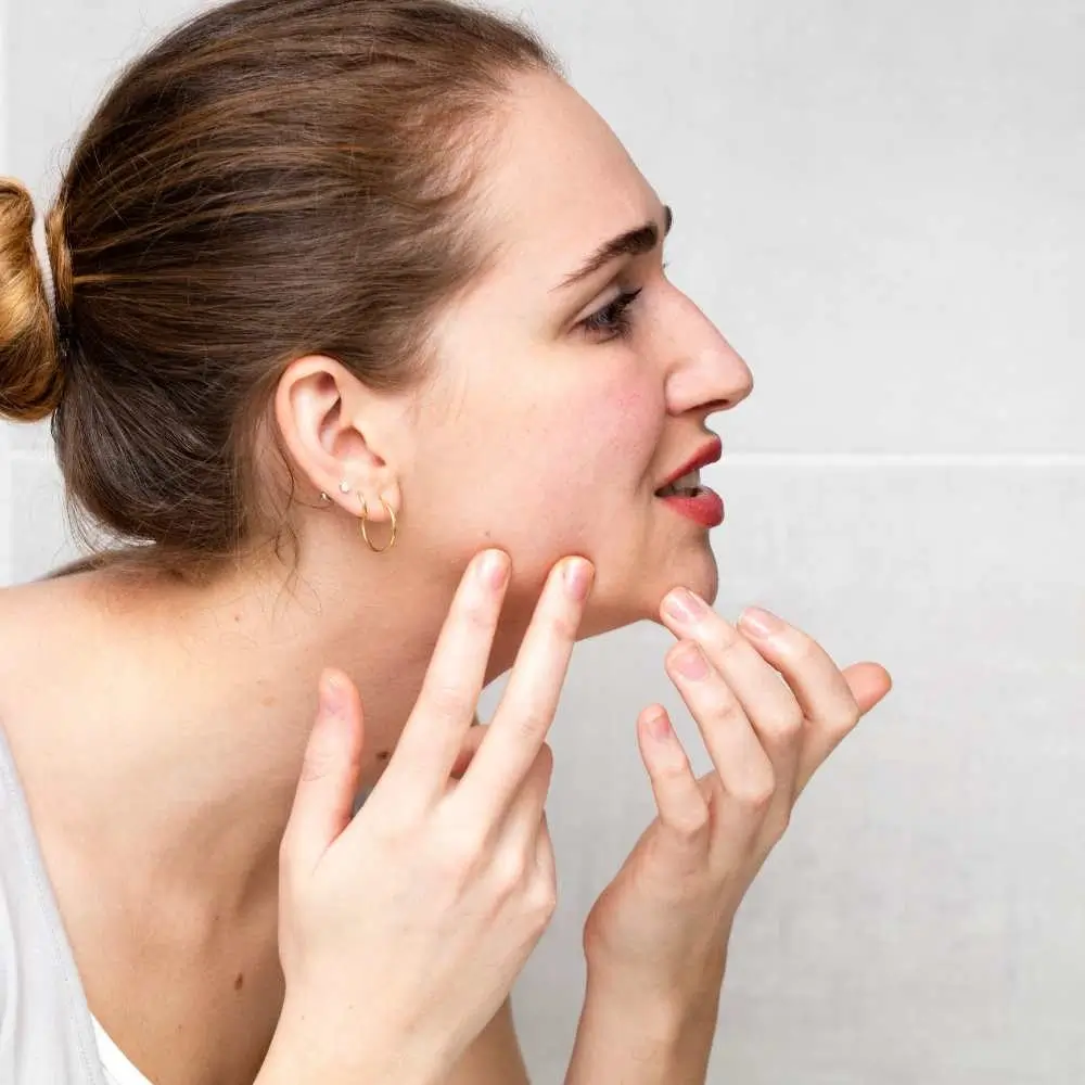 closeup side view of a woman checking her acne-prone skin