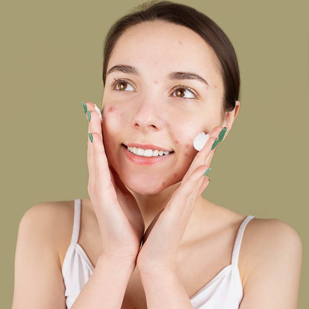 Woman delightfully applying the best night cream for acne-prone skin