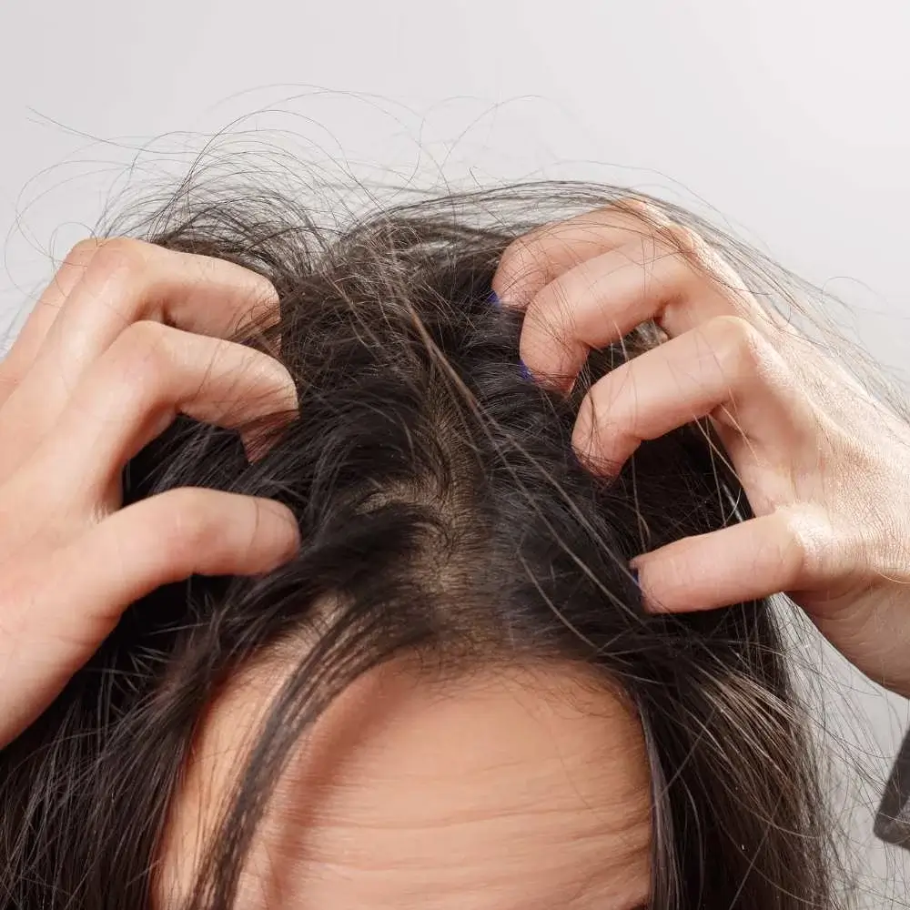 Person scratching their head, indicative of an itchy scalp