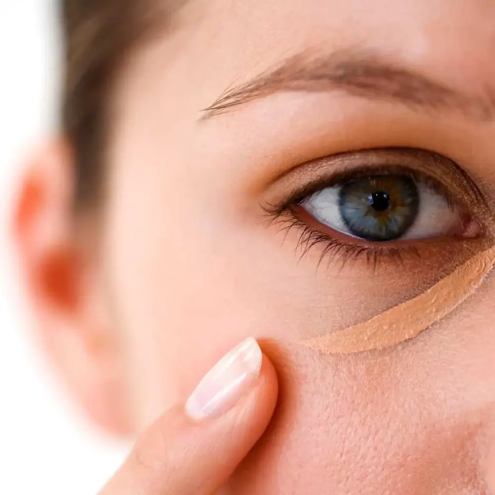  showing the magic of concealer on dark circles