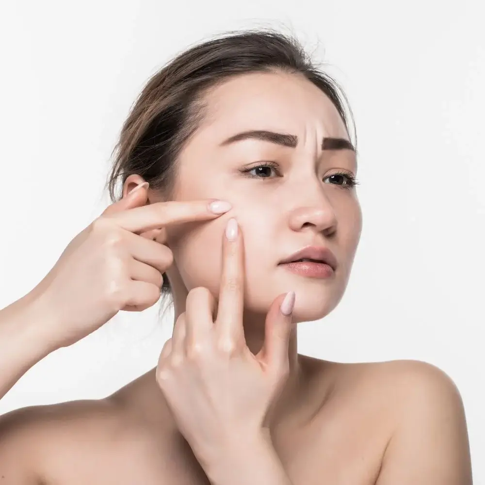 Can I wear blush if I have acne-prone skin?