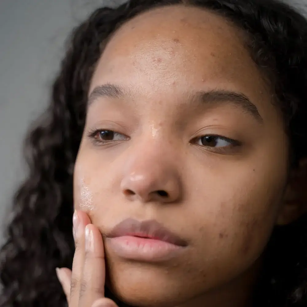 Is powder blush better for acne prone skin?
