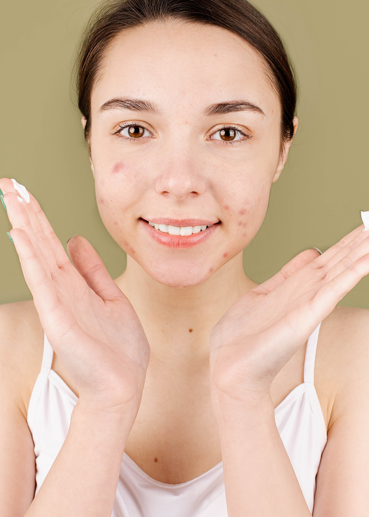Best Primer for Acne Prone Skin