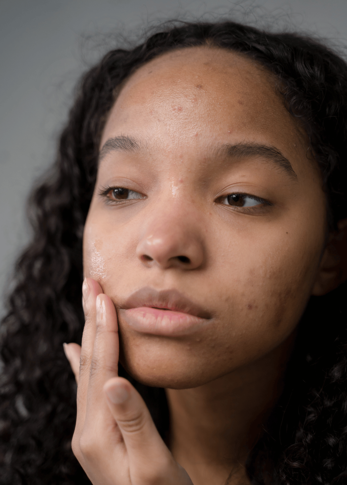 Applying Primer For Acne Scars: What You Need to Know