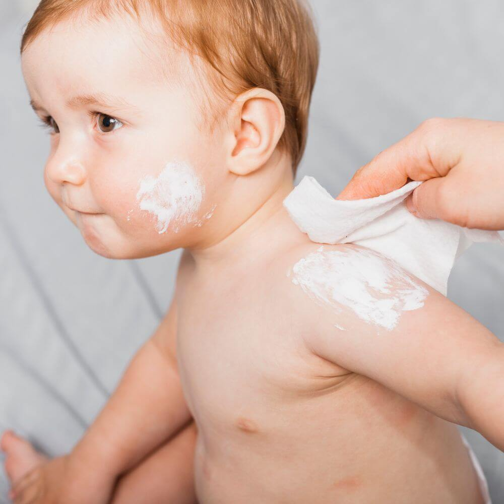 Is Sunscreen Necessary for Eczema?