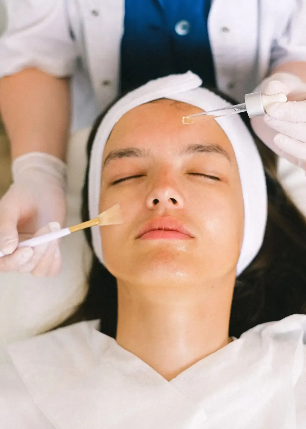 How to choose the right moisturizer after chemical peel?