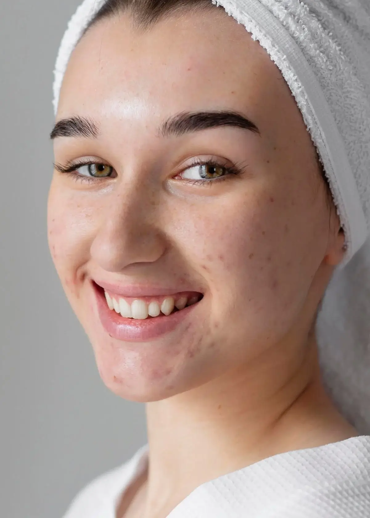 How to choose the right primer for large pores and acne scars?