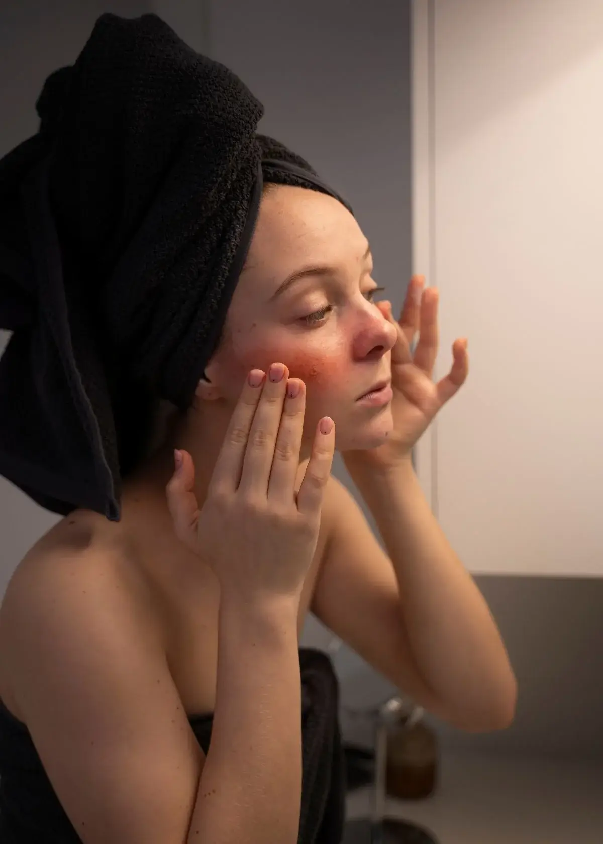 What ingredients should i look for in a moisturizer for fungal acne?