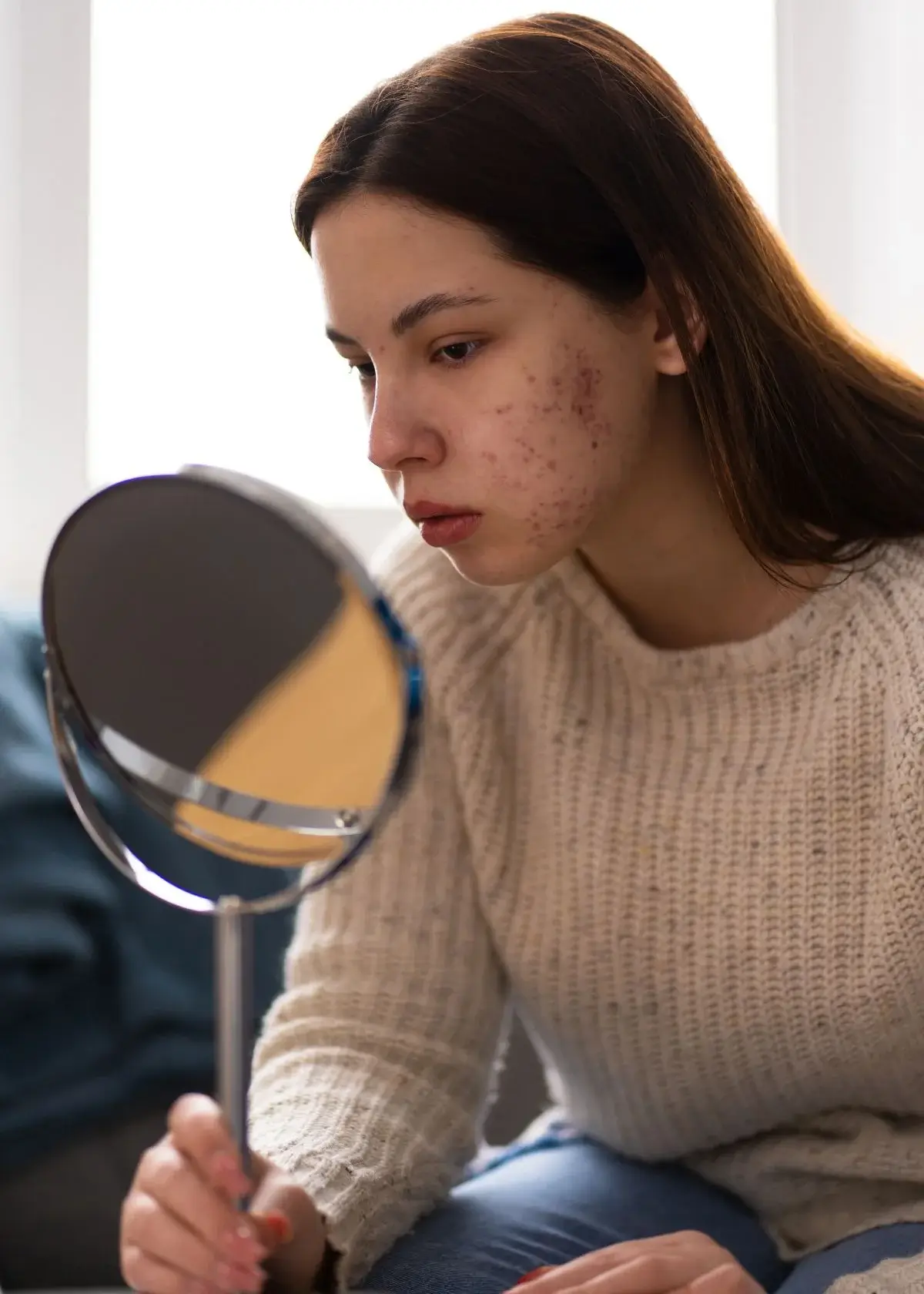 How to choose the right foundation to cover acne scars?