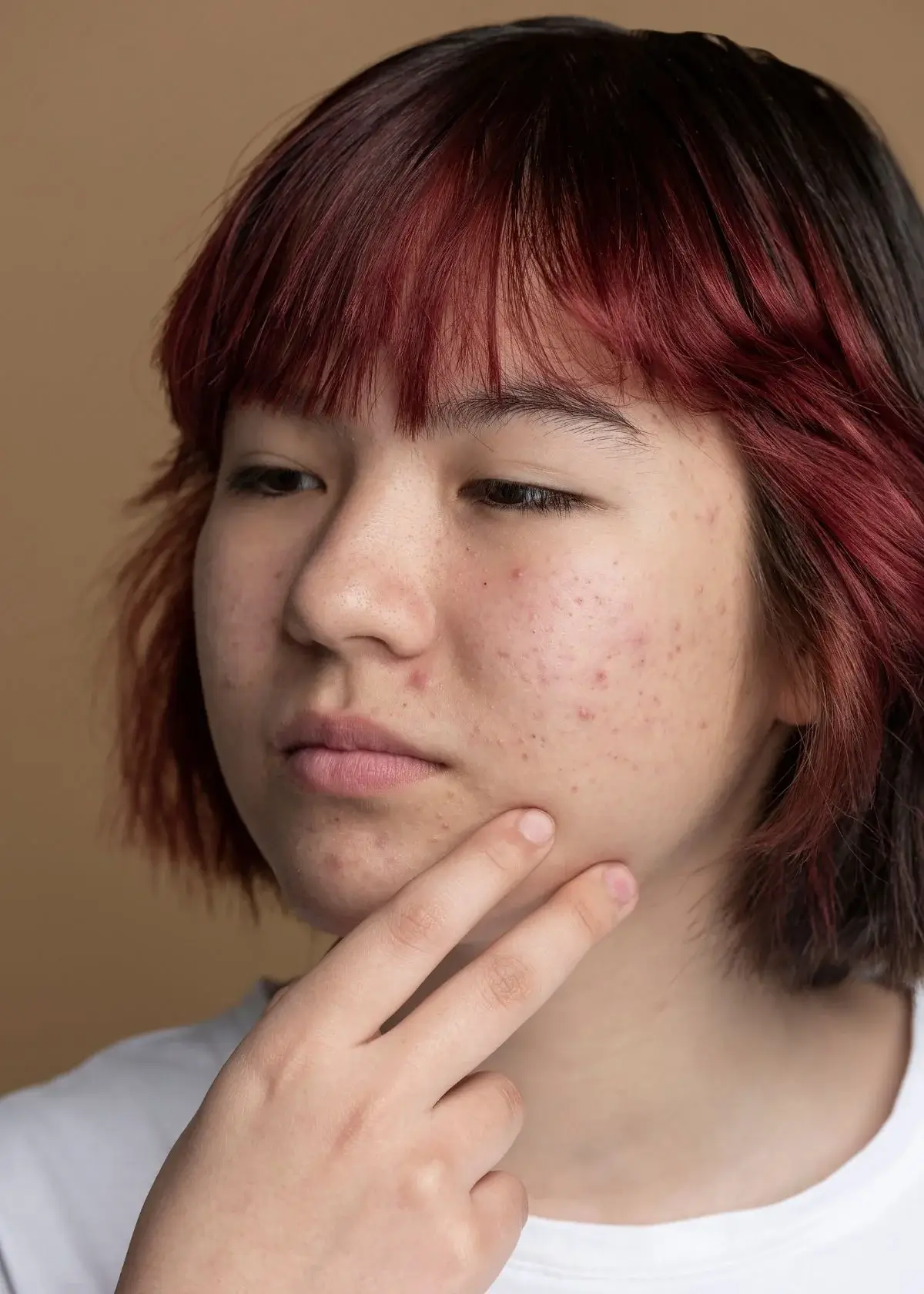 What type of makeup should I use for acne scars?