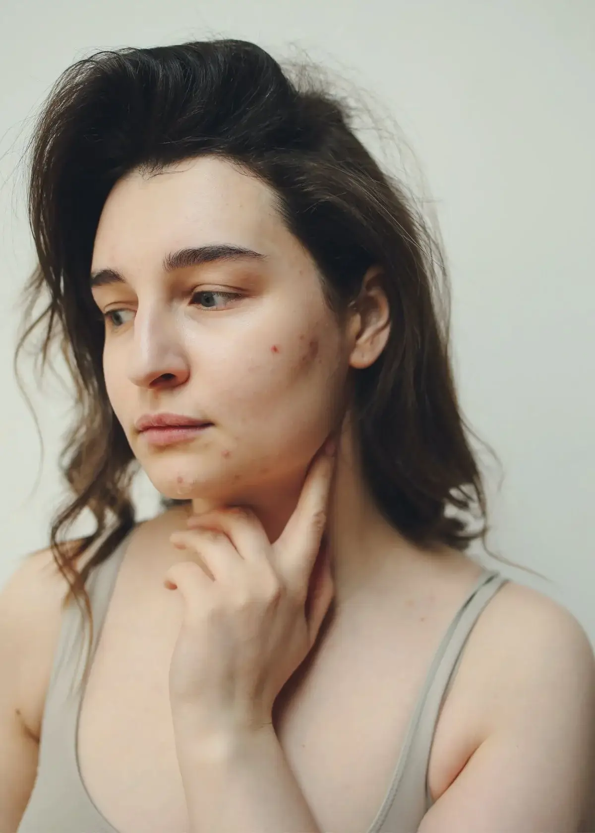 How to choose the right retinol for acne?