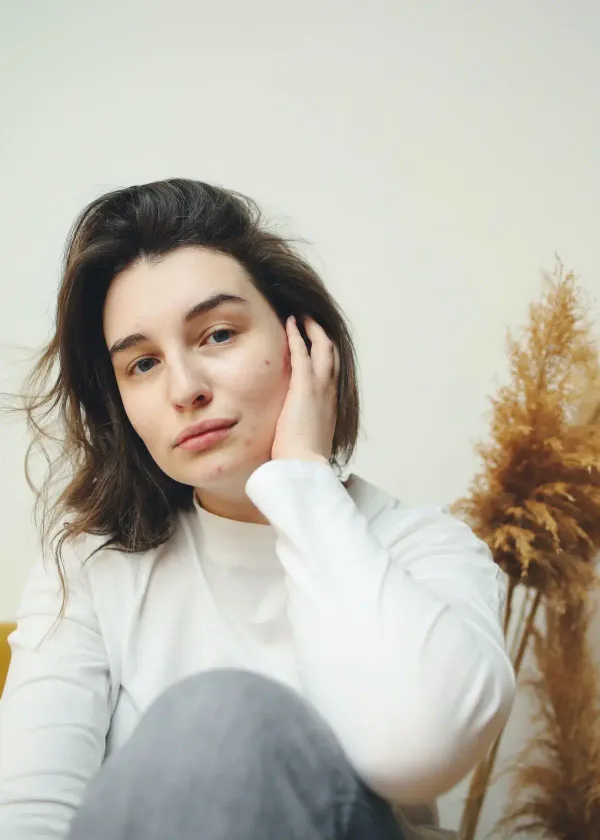 What gets Rid of Hormonal Acne fast?