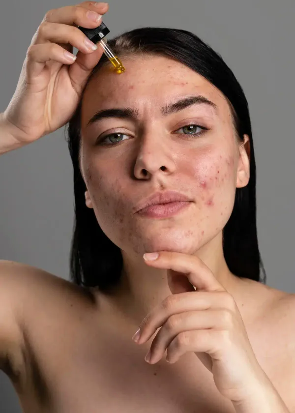Pore No More: The Expert-Approved Technique for Applying Primer to Zap Acne Scars and Pores into Oblivion!