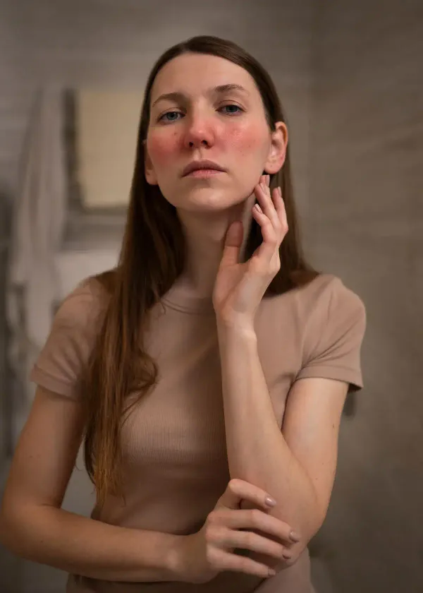The Azelaic Acid Trend: What You Need to Know About This Skin-Transforming Wonder!