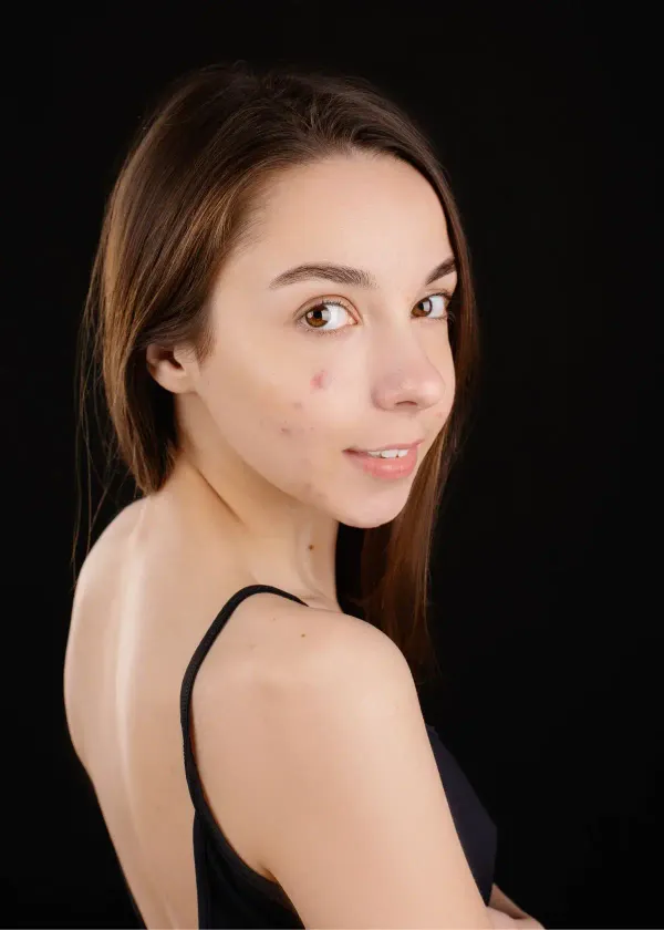 Shine Brighter Than Your Highlight: The Game-Changing Role of Exfoliation in Acne Face Washes Revealed!